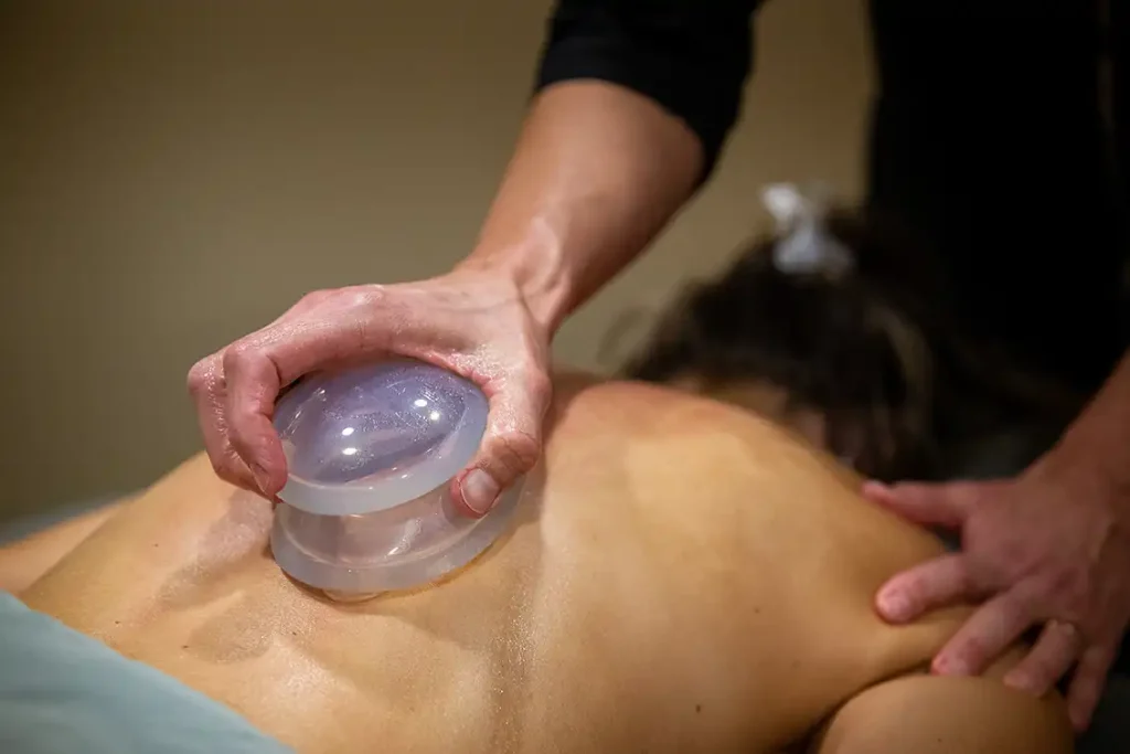 A massage therapist uses cups on a client's back.